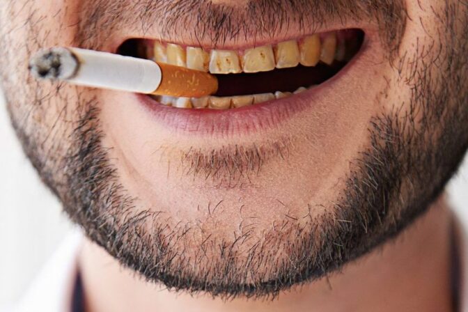 Perché i denti ingialliscono?